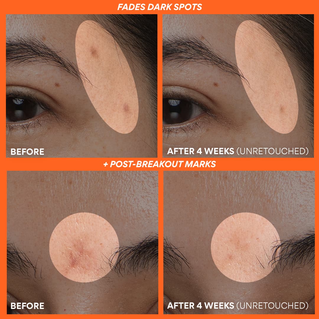 15-vitamin-c-serum-duo-5.jpg Vitamin C Serum Duo