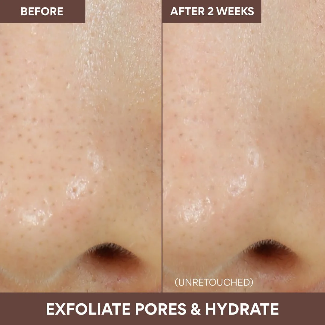 25-volcanic-swirl-pore-mask-4.webp Volcanic Swirl Pore Mask