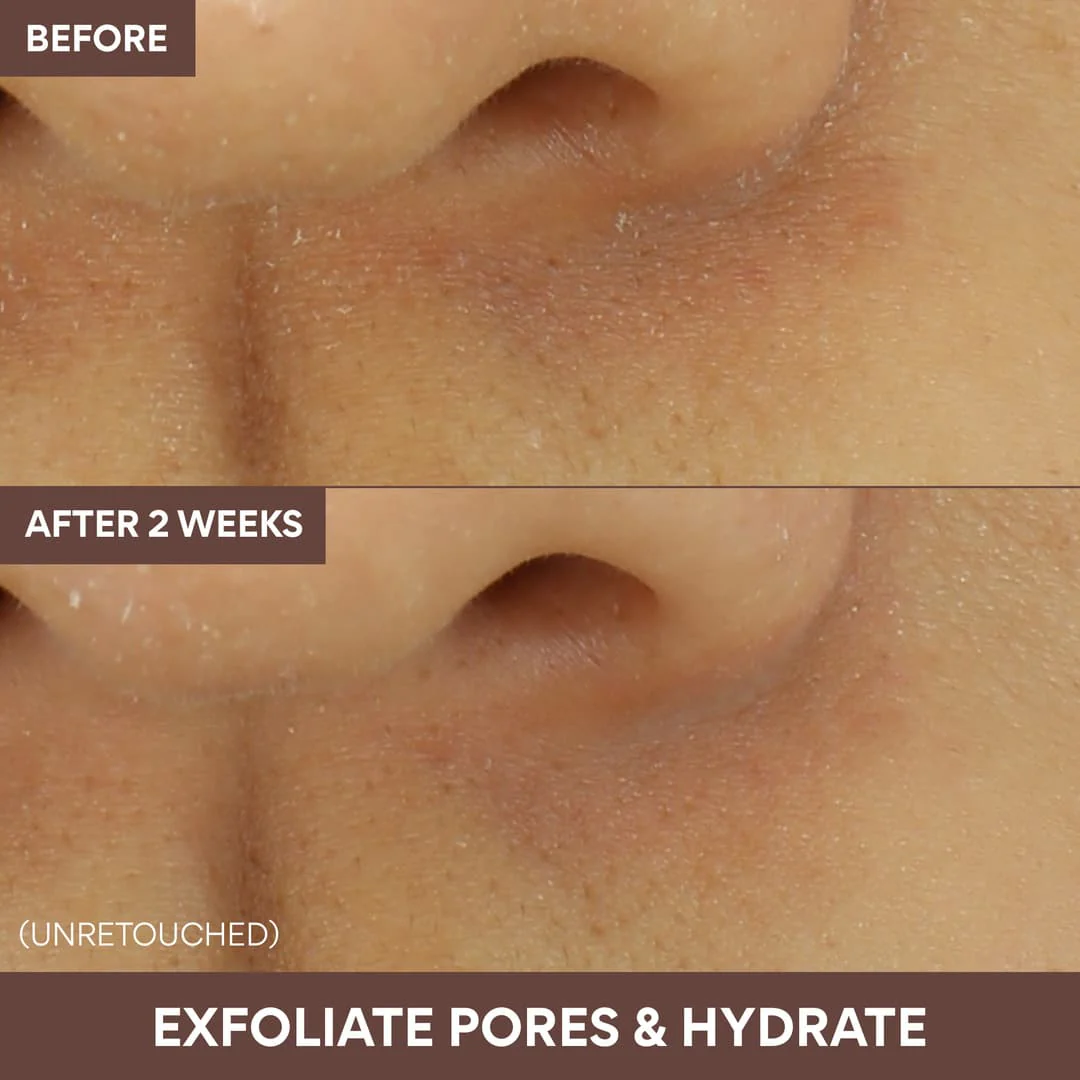 25-volcanic-swirl-pore-mask-5.webp Volcanic Swirl Pore Mask