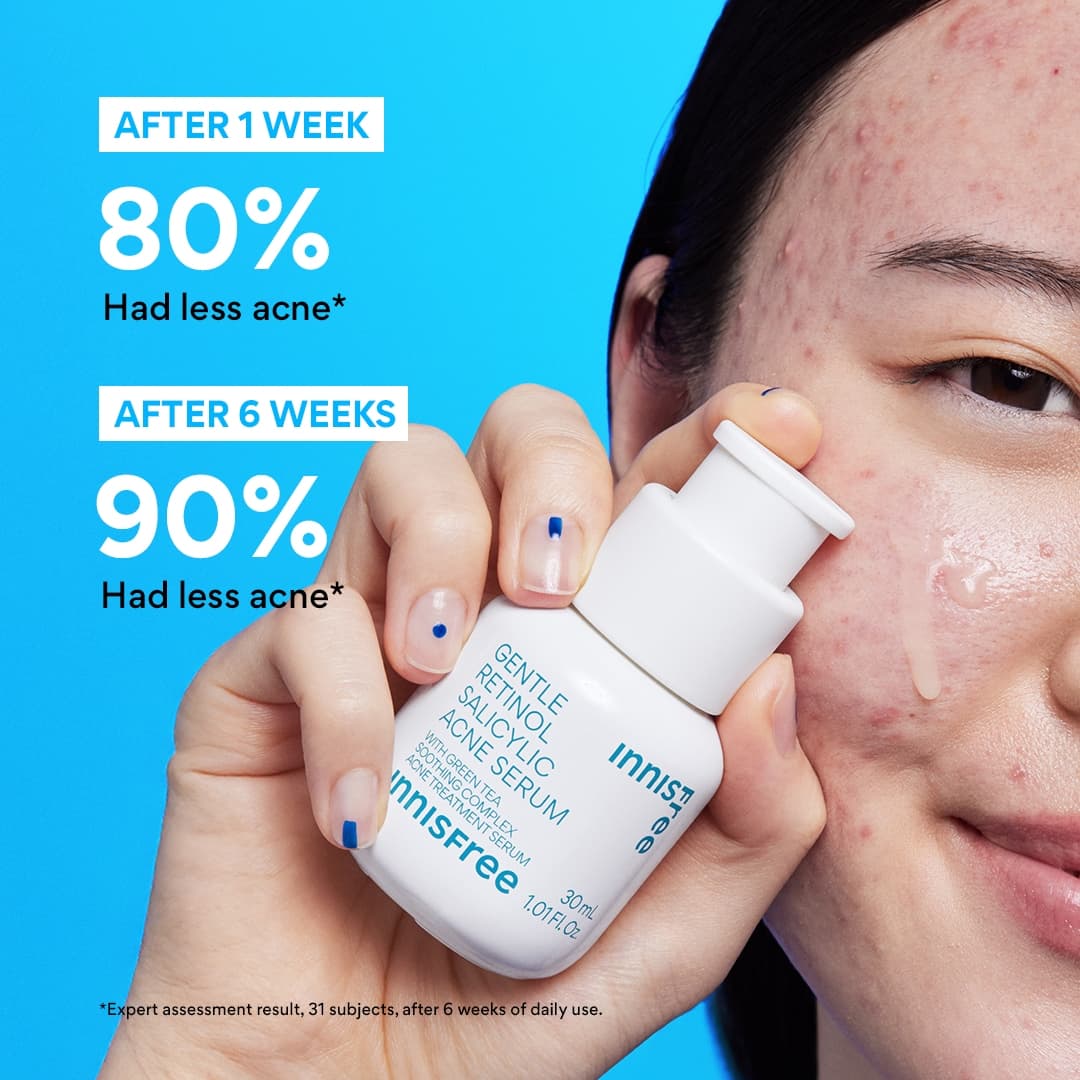 28-gentle-retinol-salicylic-acne-serum-3.jpg Gentle Retinol Salicylic Acne Serum